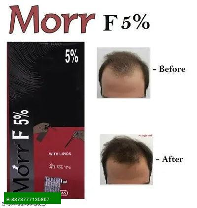 Product Revitalize Your Hair with Our Premium Hairfall & Thinning Solution!If you're struggling with hairfall and thinning, our specially formulated treatment is just what you need. Enriched with natural ingredients, it strengthens your hair from the root