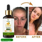 BestoSale.Com-Image 1-Illuminate Your Skin with Vitracos Professional Vitamin C Face SerumTransform your skincare routine with our Vitracos Professional Vitamin C Face Serum. This powerful serum is designed to enhance your skin's natural glow while providing essential anti-aging benefits. Infused with potent vitamins and antioxidants, it works tirelessly to repair and rejuvenate your skin.

Skin Brightening: Say goodbye to dullness! Our serum promotes a luminous complexion.

Anti-Aging: Reduce t