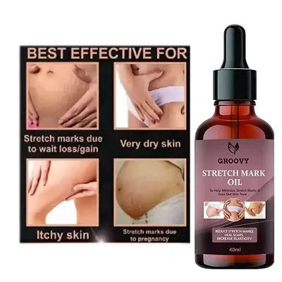 STRETCH MARKS OIL FOR ANTI STRETCH MARK PACK OF 1