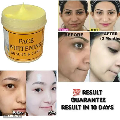 Whitening Cream For Private Parts To Remove Melanin Underarm-Elbow-Neck-Private Part Whitening Cream To Remove Melani For Men  Women (50gm) Pack of 1