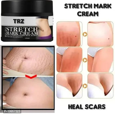 Stretch Mark Removing Cream