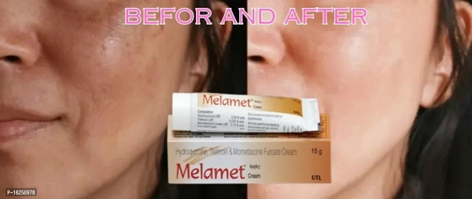 Melamet Fairness Cream Also Reduces Scars, Marks, Day  Night Cream And Dark Circles (15gm Each) (Pack Of 4)