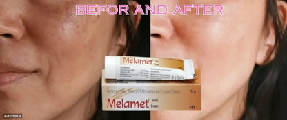 Melamet Fairness Cream Also Reduces Scars, Marks, Day  Night Cream And Dark Circles (15gm Each) (Pack Of 4)