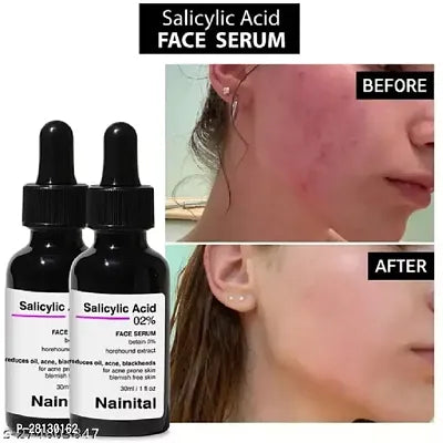 Clear Up Your Skin with Our 2% Salicylic Acid Serum 30ml Pack of 2