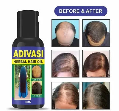 Adivasi Herbal Hair Oil For Hair Growth 60ML