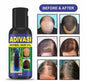 Adivasi Herbal Hair Oil For Hair Growth 60ML