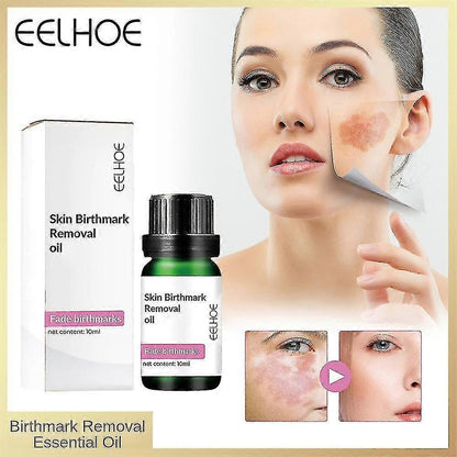 Birthmark Removal Oil 10ML (Pack of 2)