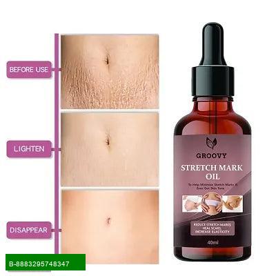 Product Revitalize Your Skin with Our Anti-Stretch Mark CreamThis premium Anti-Stretch Mark Cream is specially formulated to help reduce the appearance of stretch marks for all skin types. Enriched with natural ingredients, it nourishes and hydrates your 