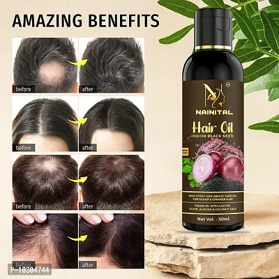 Onion Oil For Hair Regrowth - Buy 1 Get 1 Free!