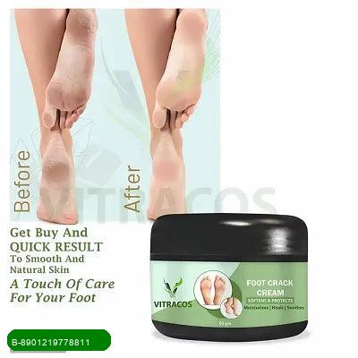 BestoSale.Com-Image 1-Revitalize Your Feet with Nutri Height Foot CreamSay goodbye to cracked heels and hello to soft, smooth feet! Nutri Height Antiseptic Foot Cream is specially formulated to nourish and repair dry, damaged skin. Infused with antiseptic properties, this cream not only hydrates but also protects your feet from infections.Key Benefits:

Deep Hydration: Provides intense moisture to cracked heels.

Antiseptic Protection: Helps in preventing infections.

Fast Absorption: Lightweigh