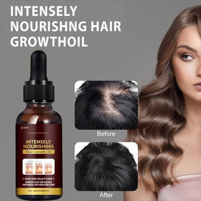 Intensely Nourishing Hair Growth Oil 30ML (Pack of 2)