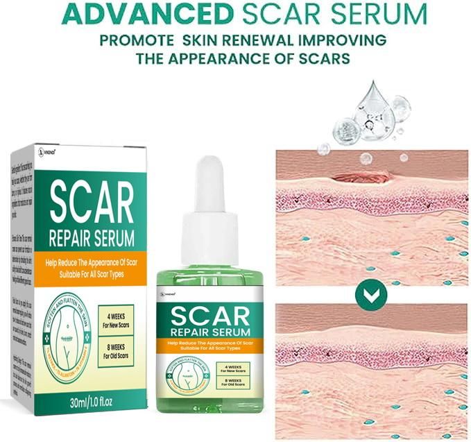 Scar Repair Serum 30ML