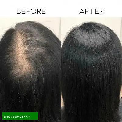 Product Revitalize Your Hair with Our Premium Hair Oil
Suitable for All Skin Types, our luxurious hair oil is designed to nourish and rejuvenate your hair from root to tip. Infused with a blend of natural oils, it penetrates deeply to provide essential mo