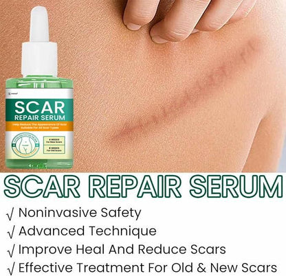 Scar Repair Serum 30ML