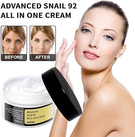 Anti Age Moisturizer for Face - 100g Age Spot Remover