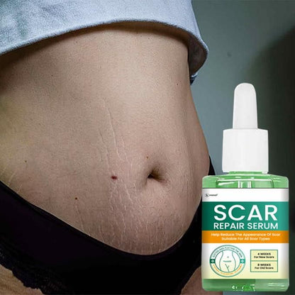 Scar Repair Serum 30ML