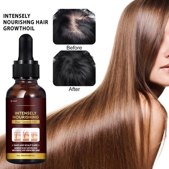 Intensely Nourishing Hair Growth Oil 30ML (Pack of 2)