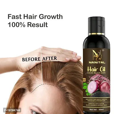 Onion Oil For Hair Regrowth - Buy 1 Get 1 Free!