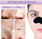 Charcoal Blackhead Remover Nose Strips (Pack of 6 Strips)