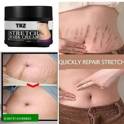 Stretch Mark Removing Cream