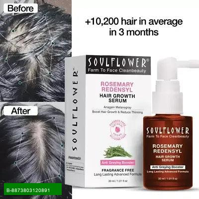 Product Revitalize Your Hair with Our Premium Hair Serum!
    Transform your hair care routine with our exceptional Hair Serum, specially formulated to suit all skin types. This lightweight serum penetrates deep into the hair shaft, providing essential nu