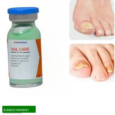 Product Revitalize Your Feet with Our Luxurious Foot Cream
Say goodbye to dry, cracked heels! Our specially formulated foot cream is designed for oily skin types, ensuring that your feet remain hydrated without leaving a greasy residue.

    
Nourishing I