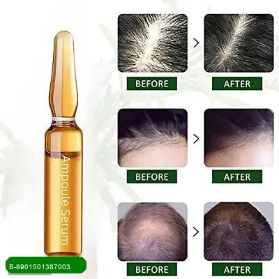 BestoSale.Com-Image 3-Revitalize your hair with our premium Nourishing Hair Oil, specially formulated to suit all skin types. This luxurious blend of natural oils penetrates deeply to hydrate and strengthen your hair from root to tip.Experience the magic of nature as it works to restore shine, reduce frizz, and promote healthy growth. With just a few drops, you can transform dull, lifeless hair into a vibrant mane that radiates health and vitality.Key Benefits:
Deeply nourishes and hydrates
Redu