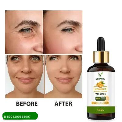 BestoSale.Com-Image 1-Revitalize your skin with the Vitracos Vitamin C Face Serum, a powerful blend designed to enhance your natural glow. This 45 ml serum is packed with antioxidants that fight free radicals and promote a youthful appearance.Formulated with high-quality Vitamin C, it helps to brighten your complexion, reduce dark spots, and improve skin texture. The lightweight formula absorbs quickly, leaving your skin feeling fresh and hydrated without any greasy residue.Key Benefits:

Bright