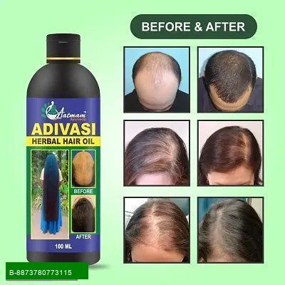 Product Revitalize Your Hair with Our Premium Hair Oil Transform your hair care routine with our exquisite Hair Oil, specially formulated to nourish and rejuvenate your locks. Enriched with natural ingredients, this oil penetrates deep into the hair shaft