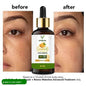 BestoSale.Com-Image 1-Illuminate Your Skin
    Discover the transformative power of Vitracos Vitamin C Face Serum. This remarkable serum is designed to provide a radiant glow while combating the signs of aging. Infused with potent antioxidants, it helps to reduce fine lines and wrinkles, giving your skin a youthful appearance.
    Key Benefits:
    
        
Brightens Skin: Achieve a luminous complexion with regular use.
        
Anti-Aging Properties: Minimizes the appearance of fine lines and 