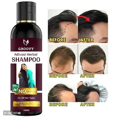 Neelambari Hair Care Anti Hair Fall Dandruff Remover Shampoo - 100 Ml